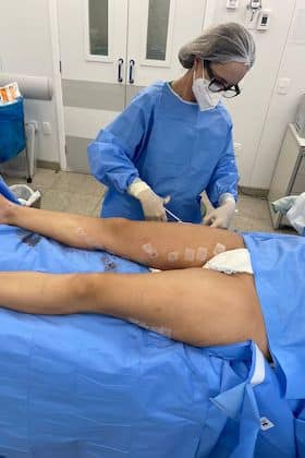 Cirurgia convencional